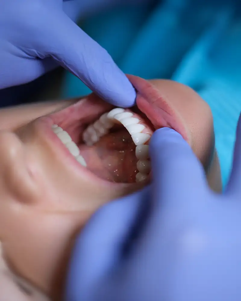 Igiene e sbiancamento