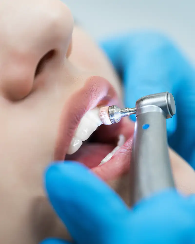 Igiene e sbiancamento